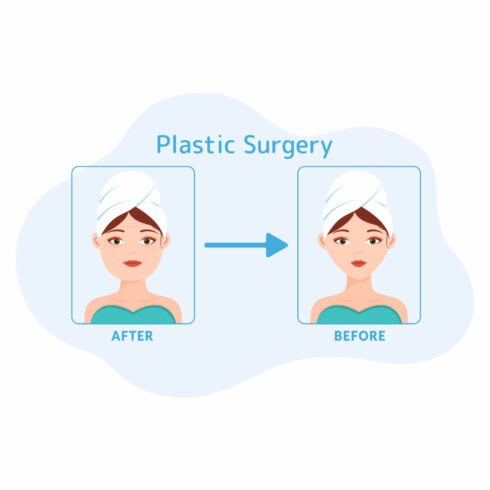 Plastic Surgery Flat Illustration cover image.