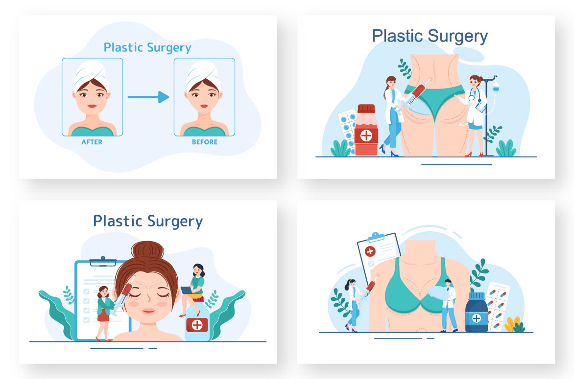 Plastic Surgery Flat Illustration preview image.