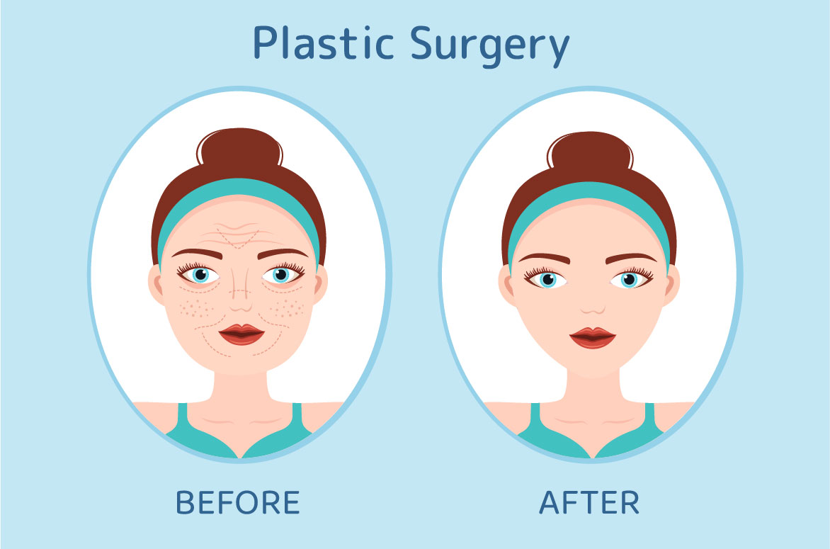 Plastic Surgery Flat Graphics preview image.