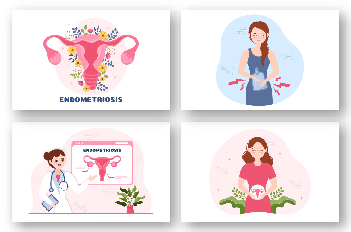Endometriosis Graphics Design preview image.