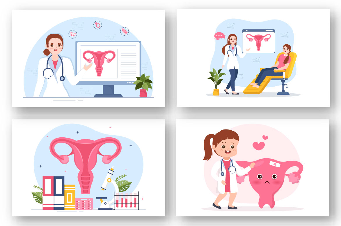Cartoon Endometriosis Illustration preview image.