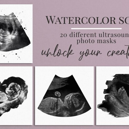 Watercolor ultrasound photomaskscover image.