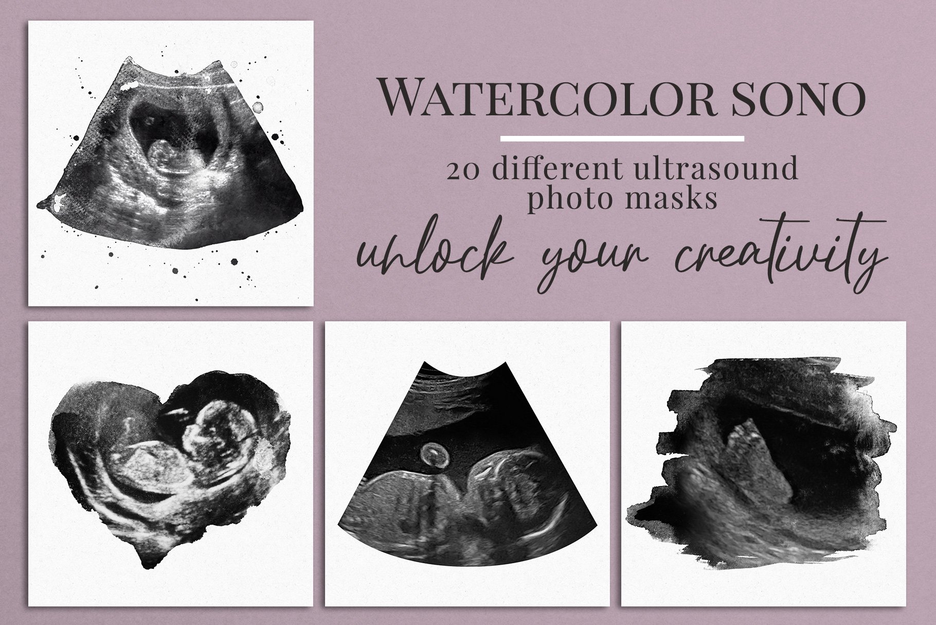 Watercolor ultrasound photomaskscover image.