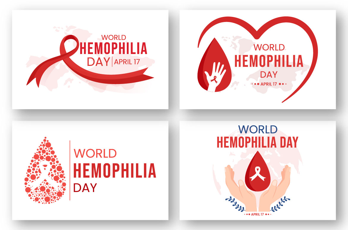 hemophilia 02 683