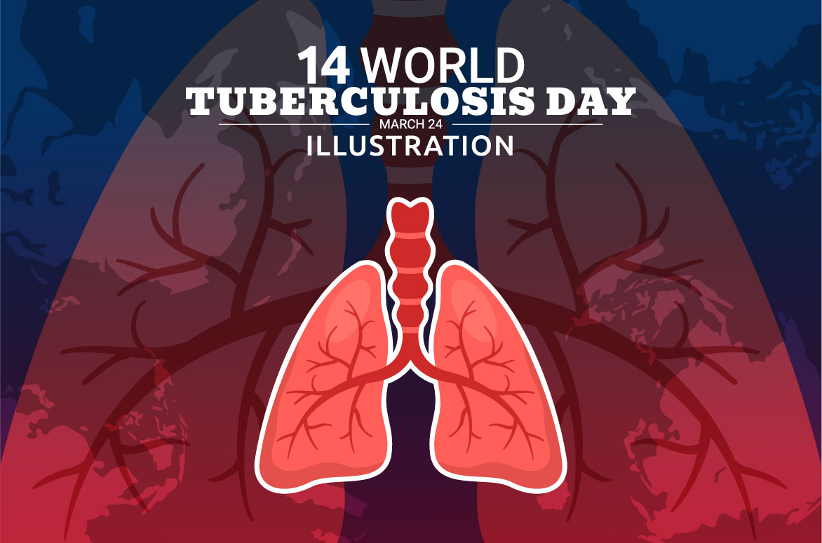tuberculosis 01 282