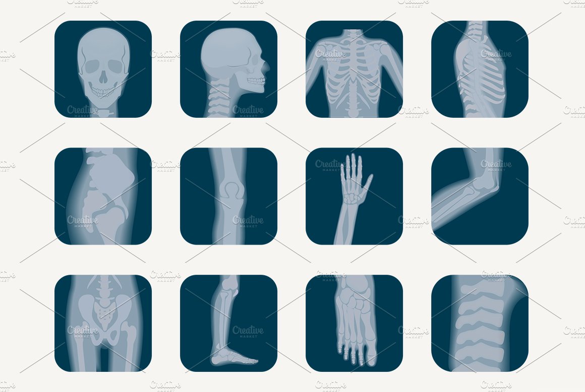 X-rays skeleton shots + icons preview image.