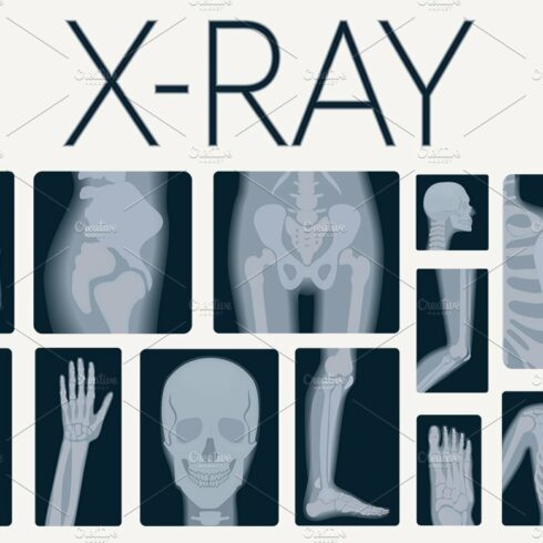 X-rays skeleton shots + icons cover image.