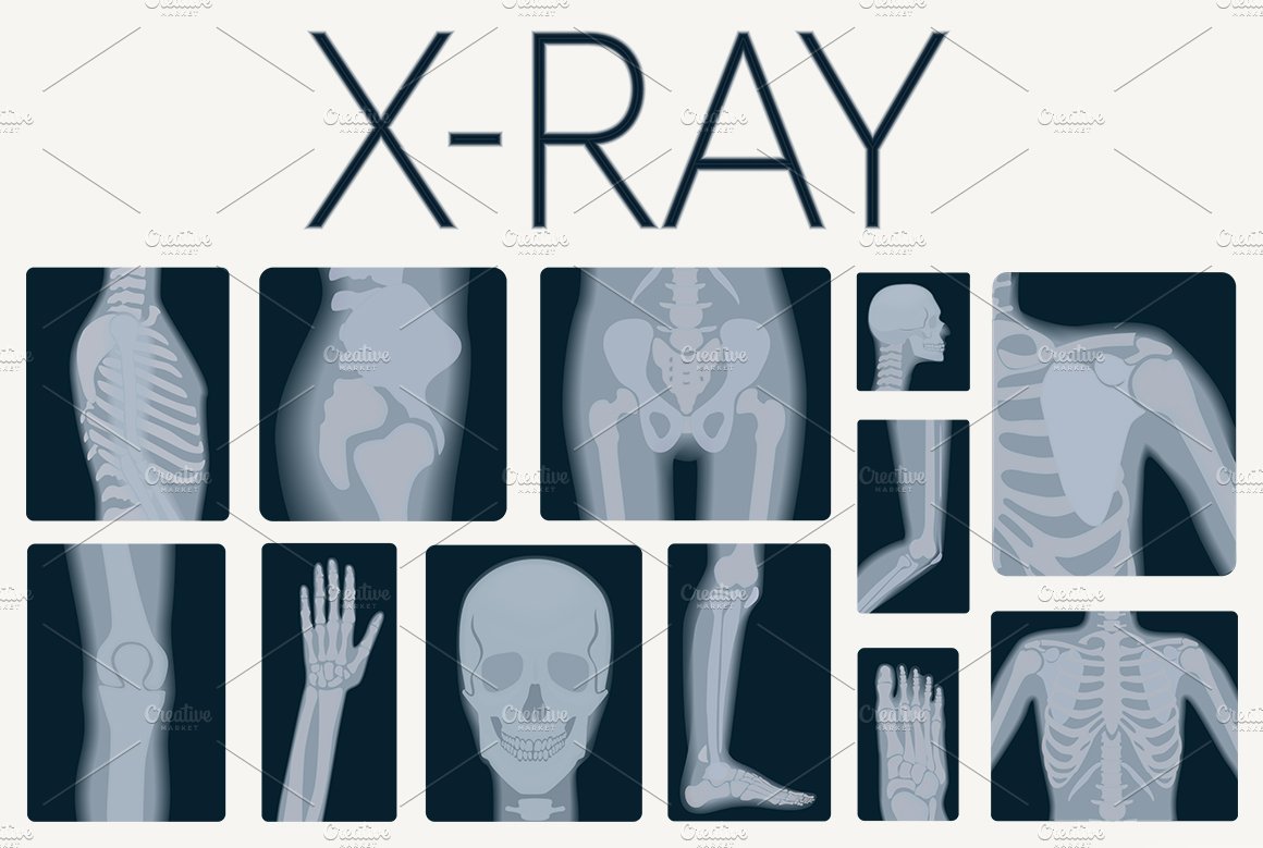 X-rays skeleton shots + icons cover image.