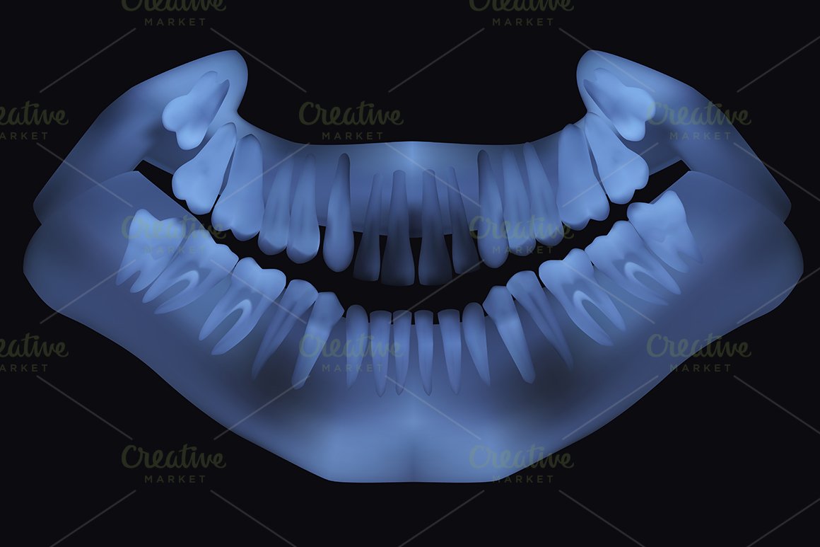 Panoramic dental X-Ray cover image.