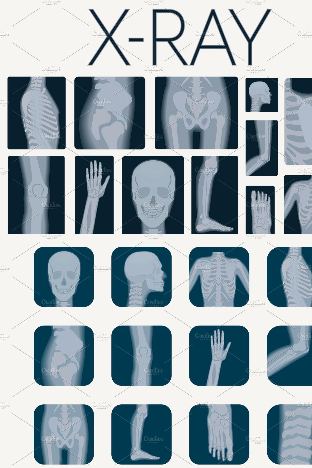 X-rays skeleton shots + icons pinterest preview image.
