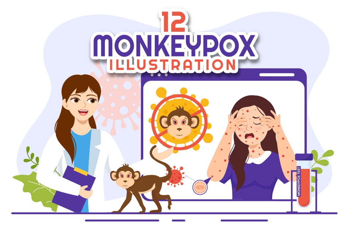 monkeypox 01 834