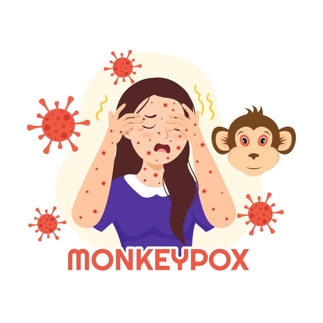 12 Monkeypox Outbreak Illustration preview image.