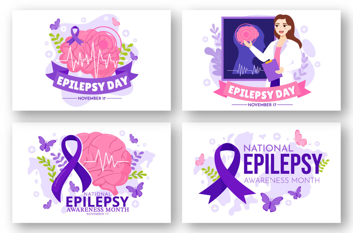 epilepsy 02 454
