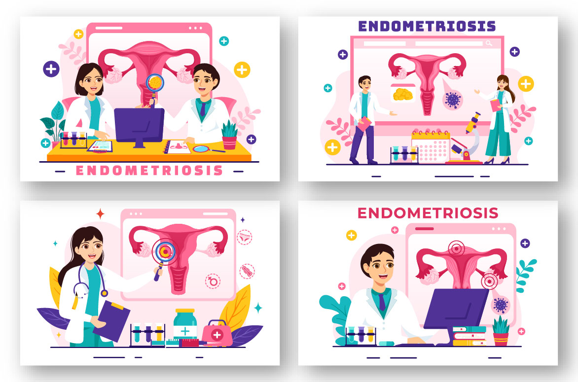 endometriosis 03 718