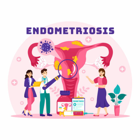 12 Endometriosis Illustration cover image.
