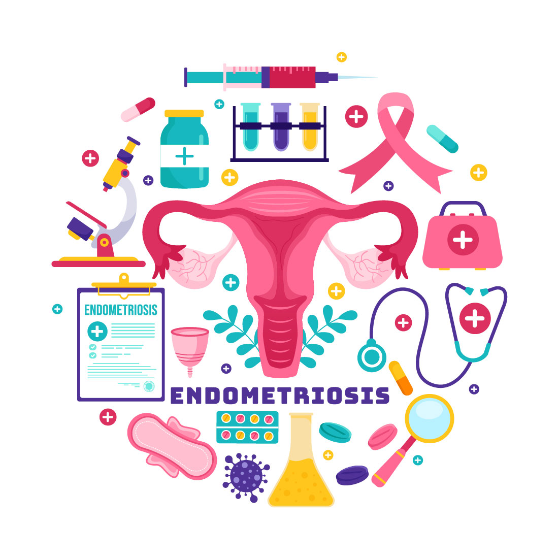 12 Endometriosis Illustration preview image.