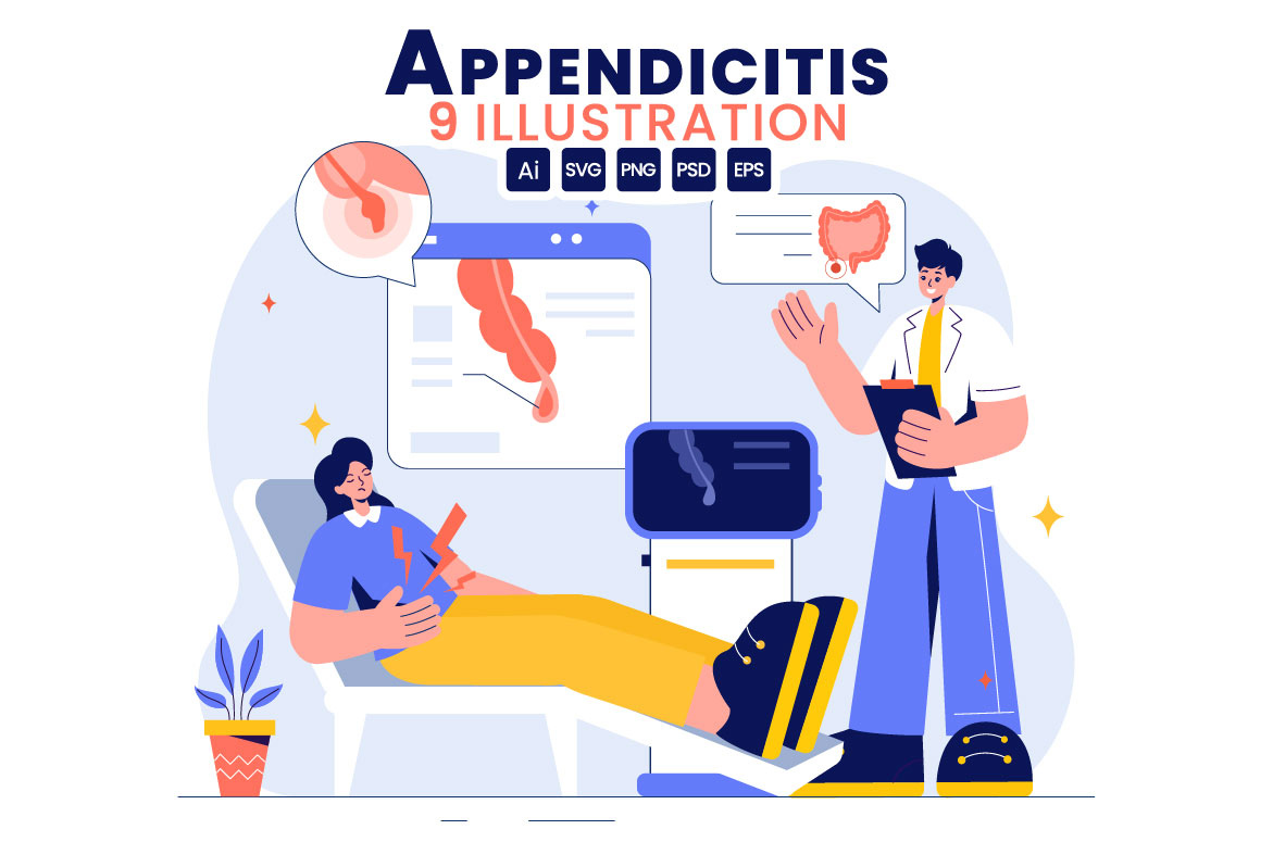 appendicitis 01 602