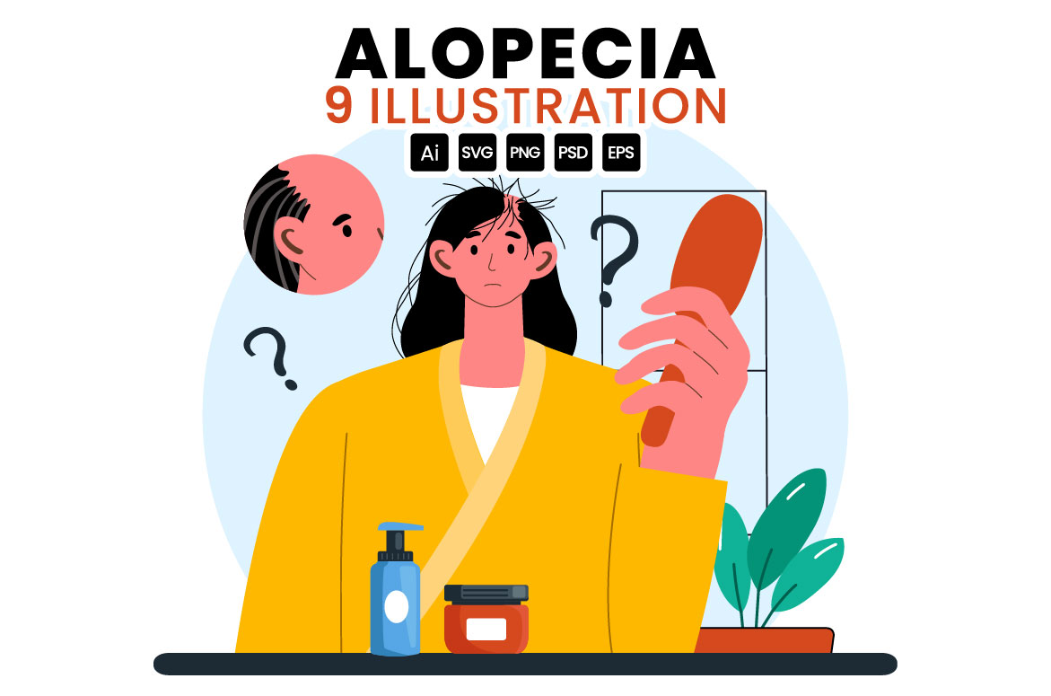 alopecia 01 925