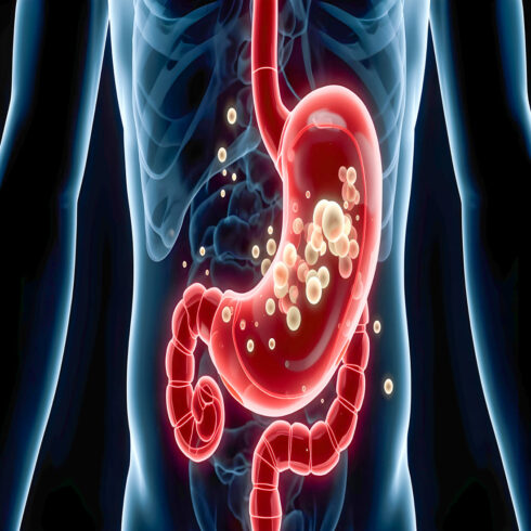 Realistic Medical Illustration of Stomach Diseases Collection, Digestive System Disorders, Gastritis Acid Reflux Ulcer IBS Infection Anatomy, No Face, 8K Poster cover image.