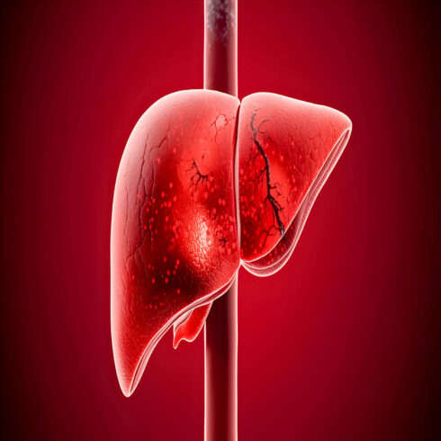 AI Generated Medical Illustration Bundle Showing Methamphetamine Ice Drug Liver Damage Inflammation Cirrhosis Toxicity Hepatic Failure Awareness Concept cover image.