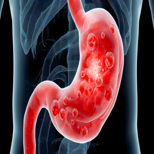 Digestive System Diseases Medical Illustration Bundle, Gut Health, Stomach Disorders, Acid Reflux IBS Gastritis Cancer Infection Anatomy, Realistic 8K Poster No Face cover image.