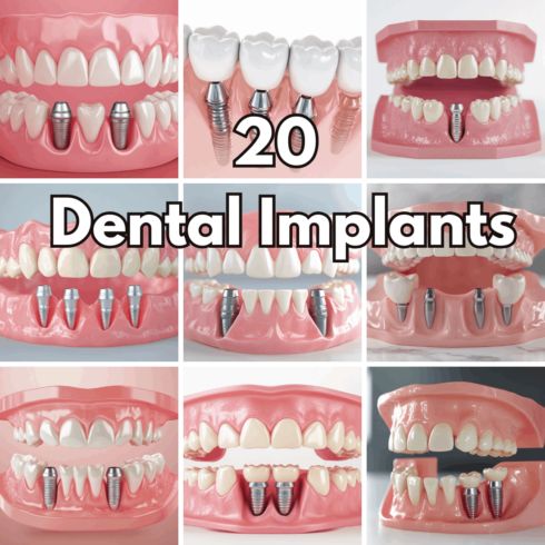 20 Dental Implants Graphics, Dental Care and Prosthetics 3D Illustrations cover image.