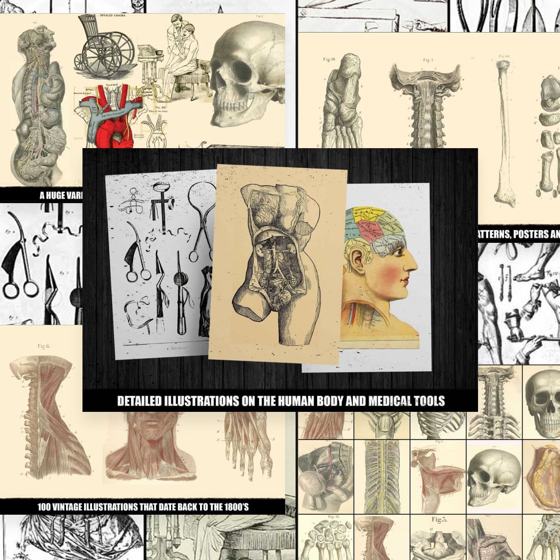 100 vintage medical illustrations preview image.