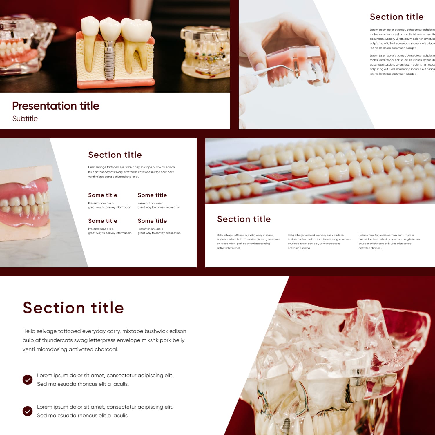 Preview Dental Implants Powerpoint.