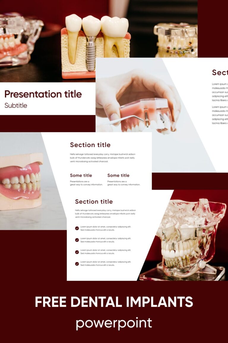 Free Dental Implants Powerpoint – MasterBundles