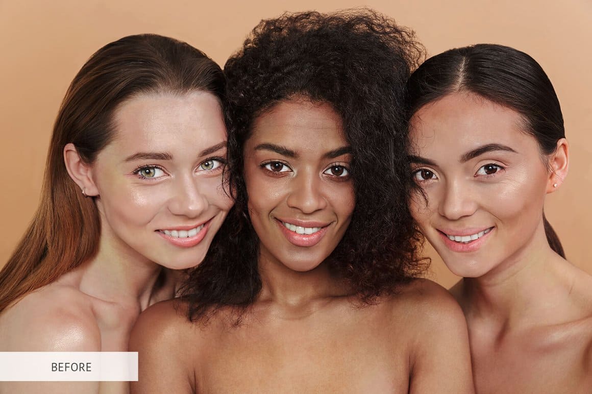 Photo of three girls with minimal skin defects.